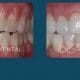 crosdental-before-after-05