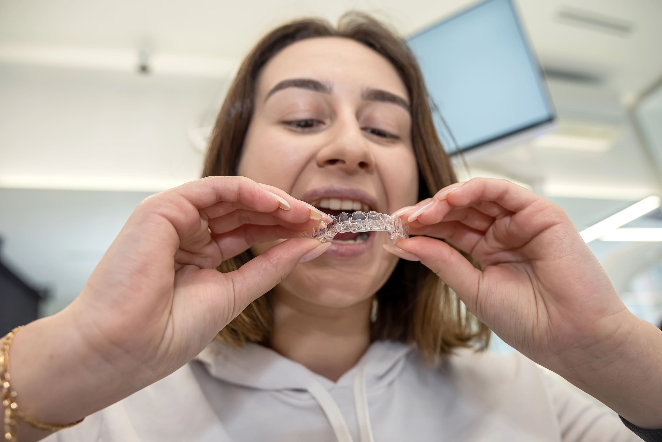 Aligners Cost: What to Expect for Your Perfect Smile